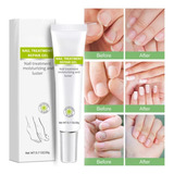 01 Nail Composto Completo Tratamento De Micose Nas Unhas
