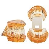 1 Peça Cor Laranja Doença Dentária Estudo Removível Modelo De Ensino De Dentes Modelo De Estudo De Implante Dentário Modelo De Demonstração De Dentes Para Estudo E Educação