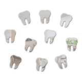 10 Unidades Espelho Decorativo Acrílico Dente Odontologia 