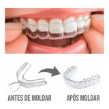 2 Pares Placa Moldeira Moldável Bruxismo 4 Unidades 