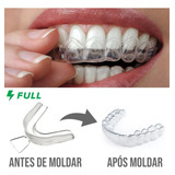 Dentes