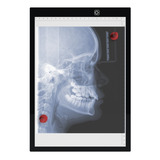 3 X Negatoscópio Com Imãs Para Radiografia Raio x Chapa A4