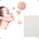 Cravos,acne,espinhas