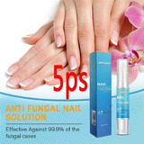 5 Bio caneta Reparação Sd Nail Care Regen Frágil Eficaz