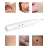 Caneta Laser Removedor Verrugas, Manchas, Tatuagem, Pintas/