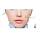 Cânula Preenchimento Facial Fabinject 25g 50mm - 10 Cânulas