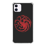 Personalizado