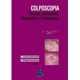 Colposcopia - Técnica, Indicações, Diagnóstico E