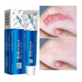 Creme Reparador De Cicatrizes Rosto Corpo