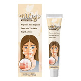 Creme Vitiligo 3 Pçs Removedor Manchas