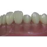 Dente Pronew 12 Dentistica