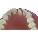 Dente Pronew 21 Dentistica