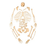 Esqueleto Humano Padrão Tamanho Natural Desarticulado