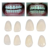 Facetas Dentárias Sup Em