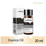 Fortalecedor Para Cabelo Natural Calvice Tem Cura Hair