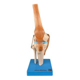 Anatomic