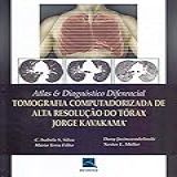 Atlas Diagnóstico Diferencial Tomografia Computadorizada De Alta Resolução Do Tórax Jorge Kavakama