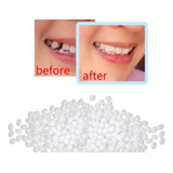 10g