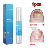 Caneta Com Solução Anti micose E Anti fungos Nas Unhas 1pcs