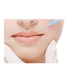 Cânula Preenchimento Aplic Hialurônico 22g X 70mm Cx C 10un
