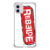 Rbd