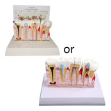 Demonstração  Teeth Model Disease Assort