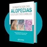 Dermatologia Das Alopecias E Estudo Dos