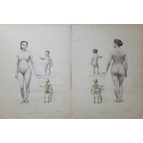Duas Litogravuras Mulher Criança Atlas Anatomia Paris 1865