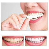 Facetas Removível Capa Snap On Smile Sup E Inf Par 