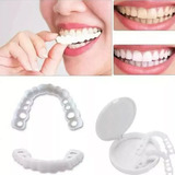 Facetas Snap On Smile Superior E Inferior par 