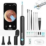 Ferramenta De Remoção De Cera De Ouvido BEBIRD- Limpador De Ouvido Spade Com Câmera De Ouvido- Escopo De Ouvido 1080P- Removedor De Cera De Ouvido Com 10 Pontas De Reposição Palito De Ouvido Com 6 Luzes Led Para Limpeza De Cera De Ouvido- Compatível Com Iphone- Preto