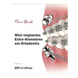 Mini Implantes Extra Alveolares Em Ortodontia, De Almeida, Marcio. Editora Dental Press, Capa Dura, Edição 1 Edição Em Português, 2018