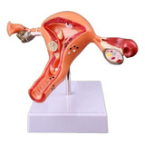 Modelo Anatomico Do Ovario