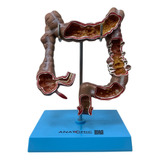 Modelo Anatomico Intestino Grosso