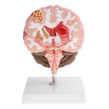 Modelo Patologico Do Cerebro